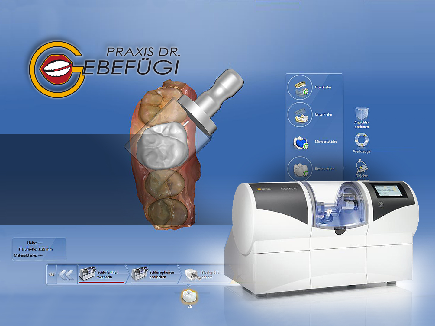 Zahnarzt Dr Gebefügi CEREC Zahnarzt Dr Gebefügi CEREC
