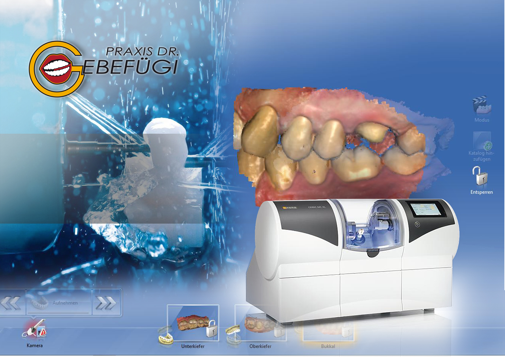 Zahnarzt Dr Gebefügi CEREC Zahnarzt Dr Gebefügi CEREC